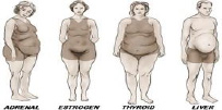 A drawing of four overweight people with the labels adrenal, estrogen, thyroid, and liver